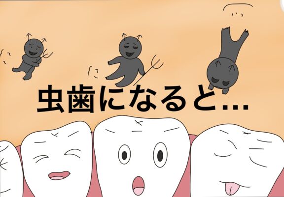 虫歯になると…